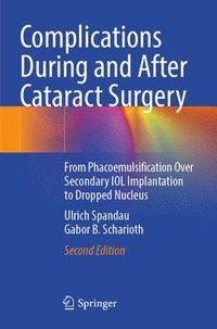 bokomslag Complications During and After Cataract Surgery