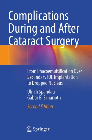 Ulrich Spandau, Gabor B. Scharioth - Complications During and After Cataract Surgery, Häftad