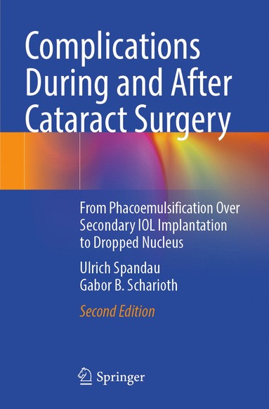 bokomslag Complications During and After Cataract Surgery