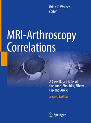 bokomslag MRI-Arthroscopy Correlations