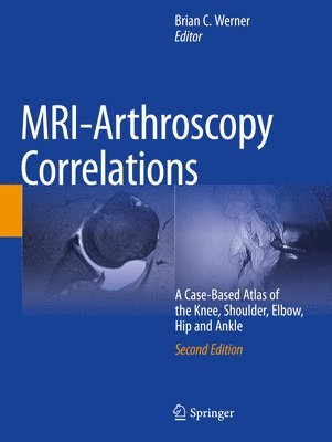 bokomslag MRI-Arthroscopy Correlations