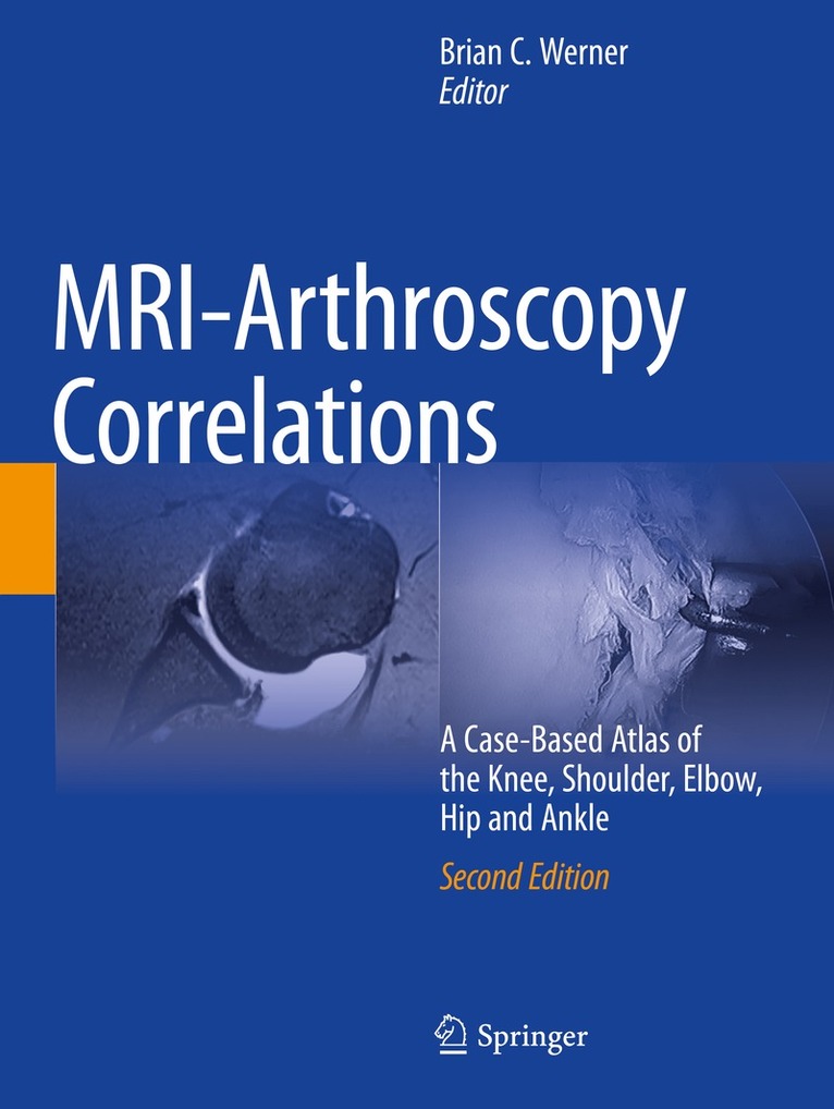 MRI-Arthroscopy Correlations