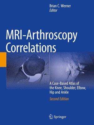 MRI-Arthroscopy Correlations 1