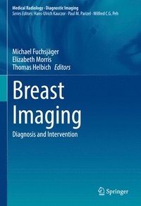 bokomslag Breast Imaging