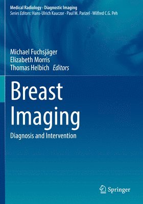 bokomslag Breast Imaging