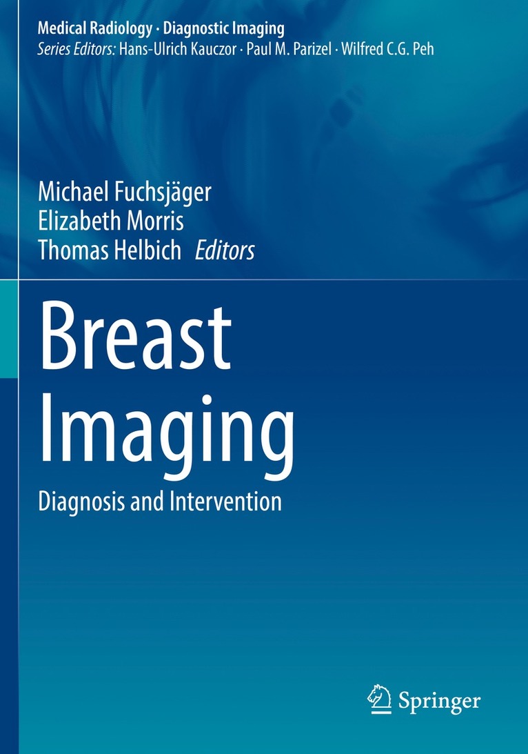 Michael Fuchsjäger, Elizabeth Morris, Thomas Helbich, Michael Fuchsjager - Breast Imaging, Häftad