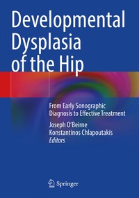 bokomslag Developmental Dysplasia of the Hip