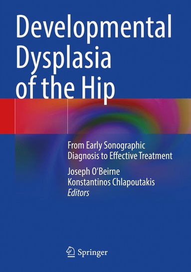 bokomslag Developmental Dysplasia of the Hip