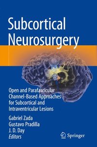 bokomslag Subcortical Neurosurgery