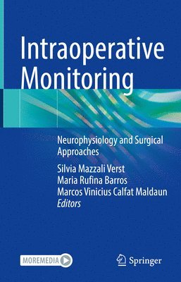 Intraoperative Monitoring 1