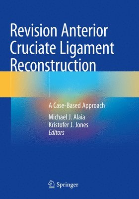 Revision Anterior Cruciate Ligament Reconstruction 1