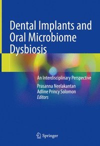 bokomslag Dental Implants and Oral Microbiome Dysbiosis