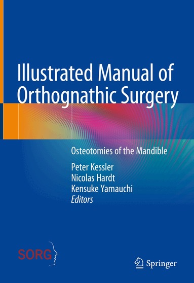 Peter Kessler, Nicolas Hardt, Kensuke Yamauchi - Illustrated Manual of Orthognathic Surgery, Inbunden