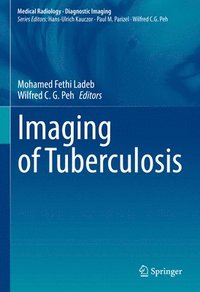 bokomslag Imaging of Tuberculosis