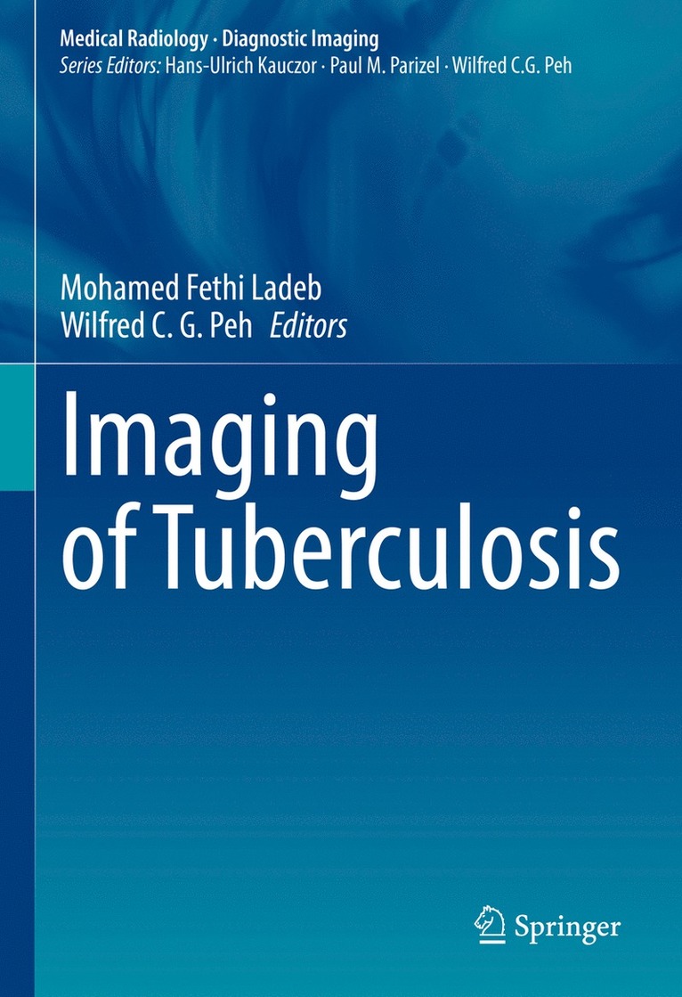 Mohamed Fethi Ladeb, Wilfred C. G. Peh - Imaging of Tuberculosis, Inbunden