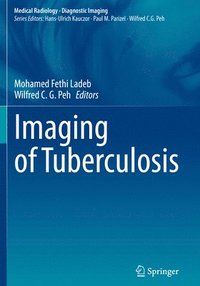bokomslag Imaging of Tuberculosis