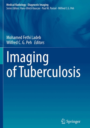 Mohamed Fethi Ladeb, Wilfred C. G. Peh - Imaging of Tuberculosis, Häftad