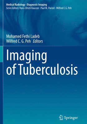 Imaging of Tuberculosis 1