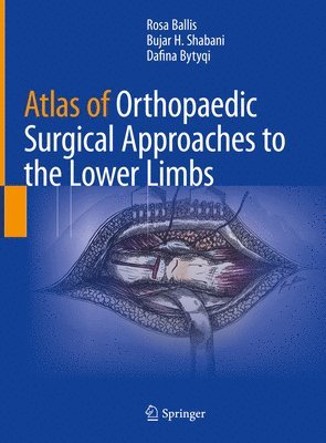 Atlas of Orthopaedic Surgical Approaches to the Lower Limbs 1