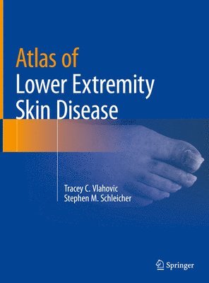 Atlas of Lower Extremity Skin Disease