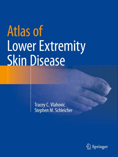 Tracey C. Vlahovic, Stephen M. Schleicher - Atlas of Lower Extremity Skin Disease, Häftad