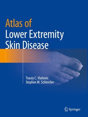 bokomslag Atlas of Lower Extremity Skin Disease