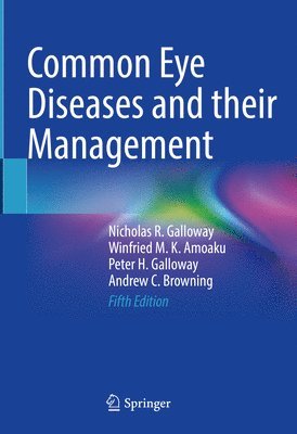 Common Eye Diseases and their Management 1