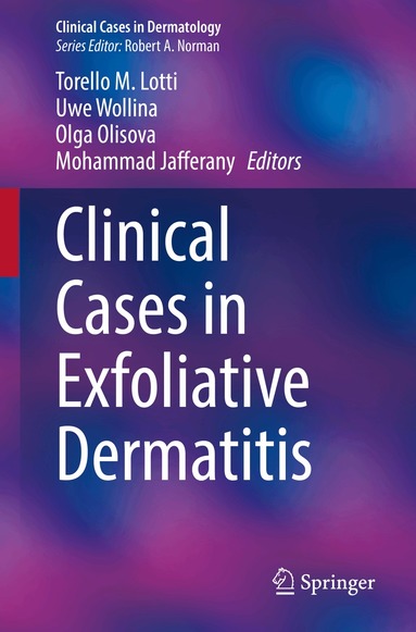 Torello M. Lotti, Uwe Wollina, Olga Olisova, Mohammad Jafferany - Clinical Cases in Exfoliative Dermatitis, Häftad