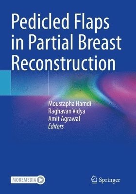 bokomslag Pedicled Flaps in Partial Breast Reconstruction