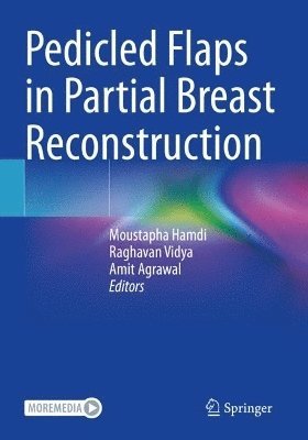 Moustapha Hamdi, Raghavan Vidya, Amit Agrawal, FCCP. Hamdi, Moustapha, MD., PhD. - Pedicled Flaps in Partial Breast Reconstruction, Häftad