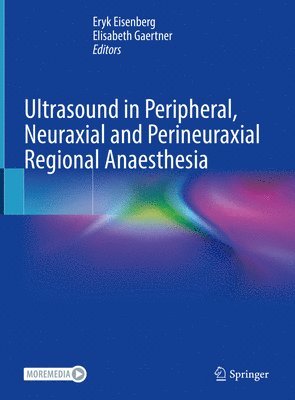 Ultrasound in Peripheral, Neuraxial and Perineuraxial Regional Anaesthesia 1