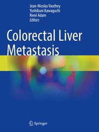 bokomslag Colorectal Liver Metastasis