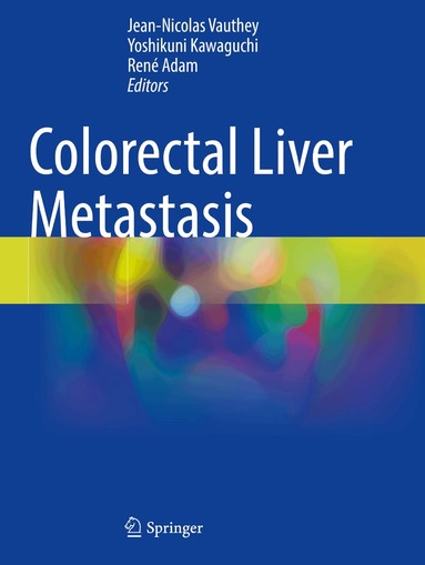 Jean-Nicolas Vauthey, Yoshikuni Kawaguchi, René Adam - Colorectal Liver Metastasis, Häftad