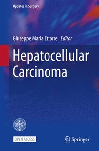 bokomslag Hepatocellular Carcinoma