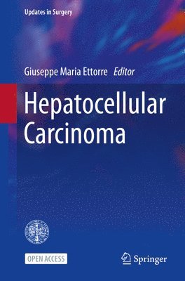 bokomslag Hepatocellular Carcinoma