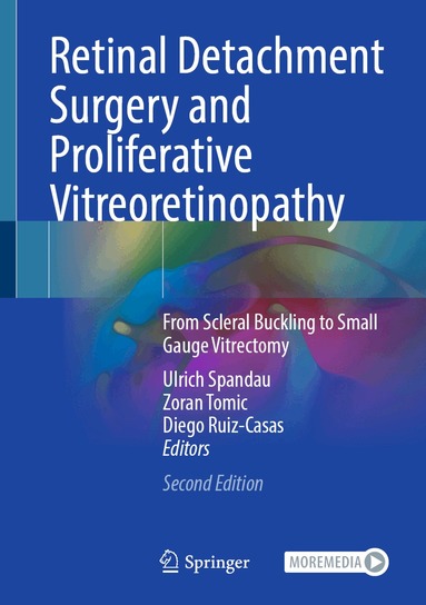 Ulrich Spandau, Zoran Tomic, Diego Ruiz-Casas - Retinal Detachment Surgery and Proliferative Vitreoretinopathy, Inbunden