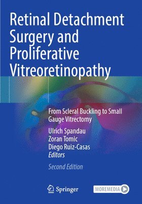 Retinal Detachment Surgery and Proliferative Vitreoretinopathy 1