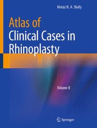 bokomslag Atlas of Clinical Cases in Rhinoplasty