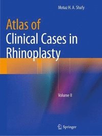 bokomslag Atlas of Clinical Cases in Rhinoplasty