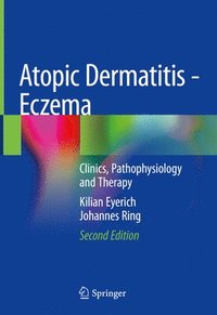 bokomslag Atopic Dermatitis - Eczema