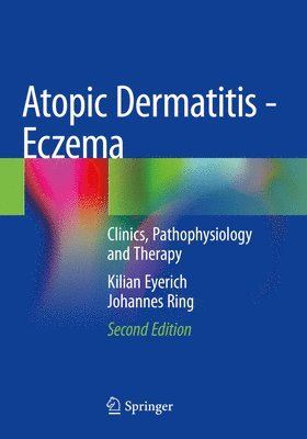 bokomslag Atopic Dermatitis - Eczema