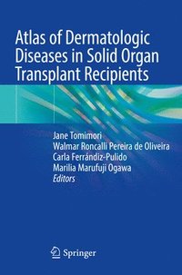 bokomslag Atlas of Dermatologic Diseases in Solid Organ Transplant Recipients