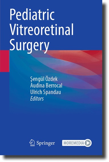 Şengül Özdek, Audina Berrocal, Ulrich Spandau - Pediatric Vitreoretinal Surgery, Häftad