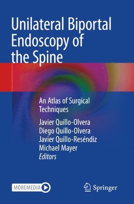 Unilateral Biportal Endoscopy of the Spine 1