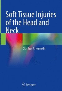 bokomslag Soft Tissue Injuries of the Head and Neck