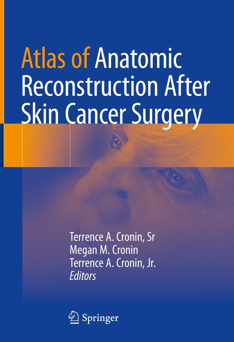 Terrence A. Cronin, Sr, Megan M. Cronin, Terrence A. Cronin, Jr., Terrence A. Cronin Sr, Sr Cronin, Jr. Cronin - Atlas of Anatomic Reconstruction After Skin Cancer Surgery, Inbunden