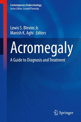 bokomslag Acromegaly