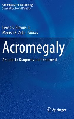 Acromegaly 1