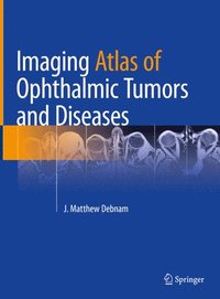 bokomslag Imaging Atlas of Ophthalmic Tumors and Diseases