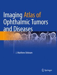bokomslag Imaging Atlas of Ophthalmic Tumors and Diseases